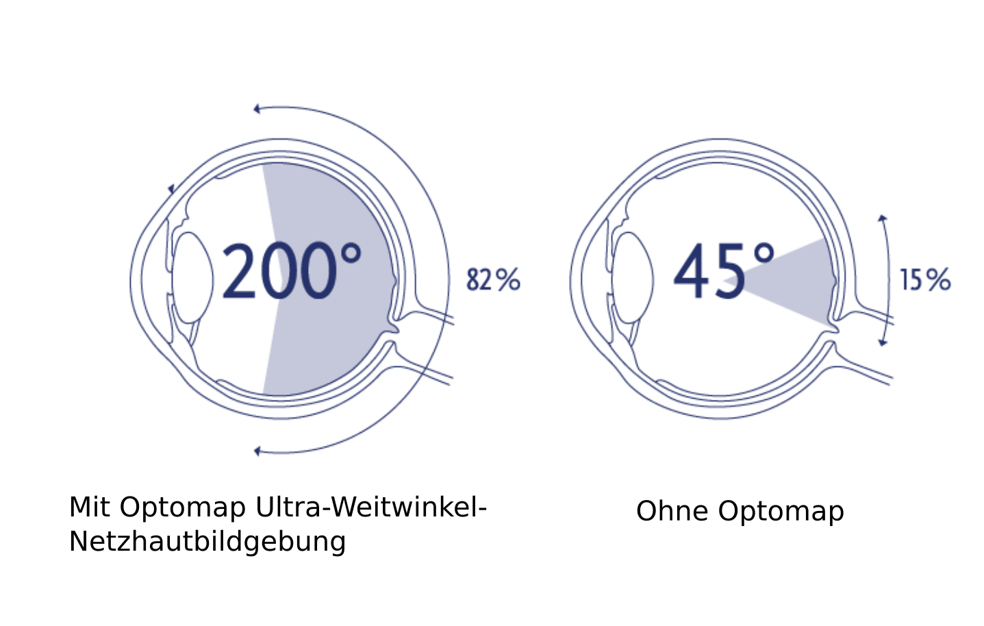 Anschauung: Mit und ohne Optomap